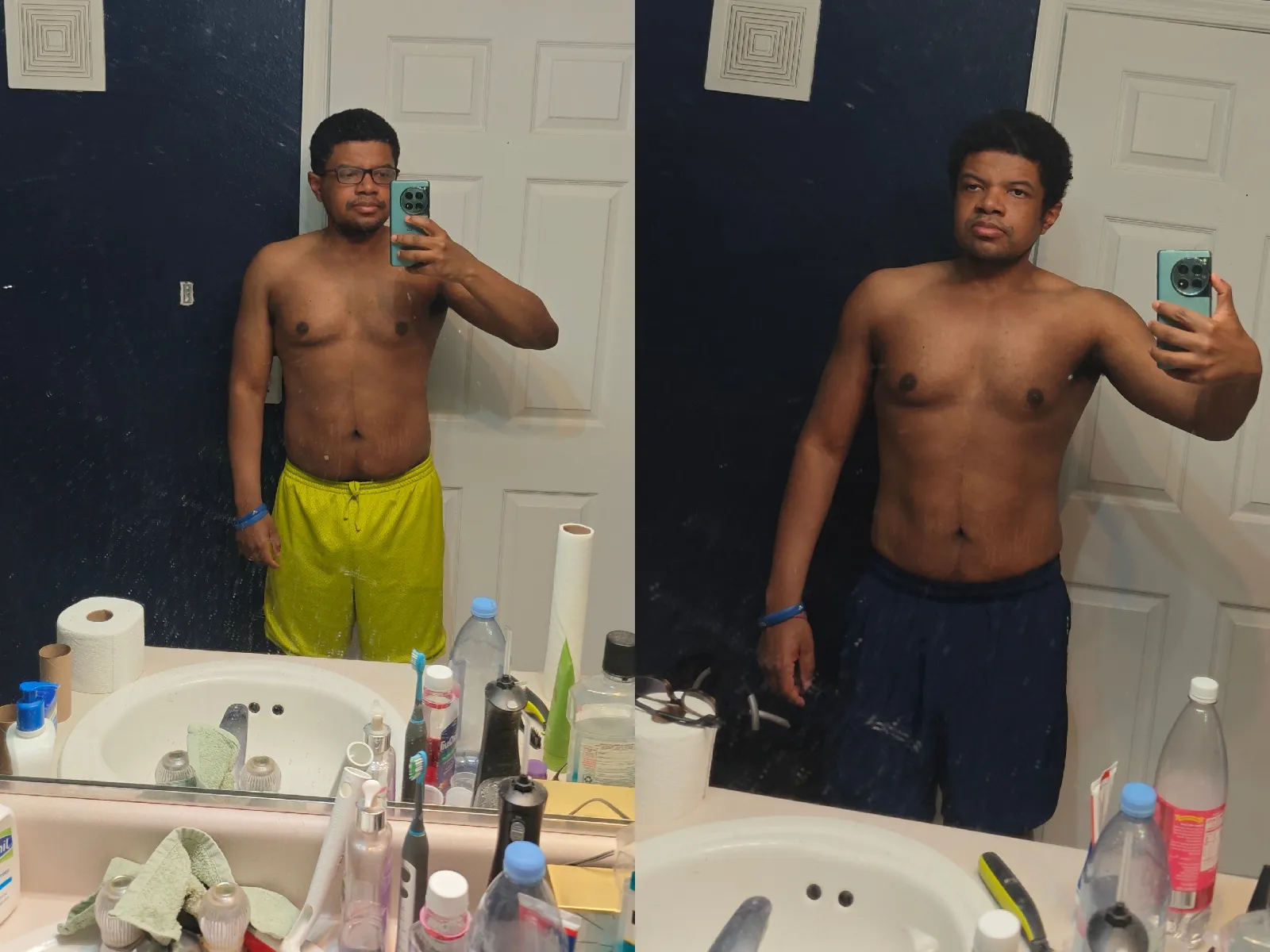 Donald transformation — before and after