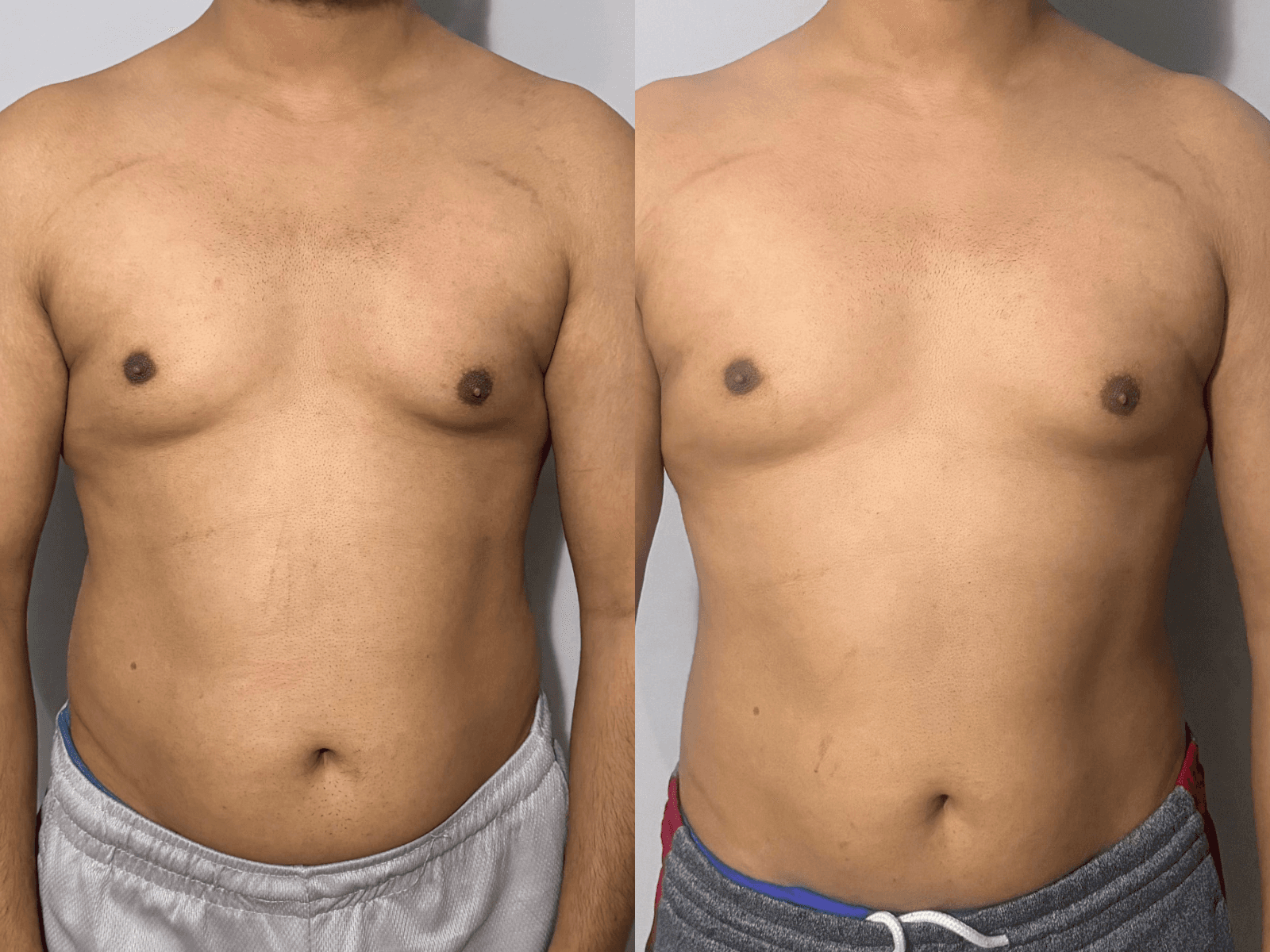 Muhamed transformation — before and after