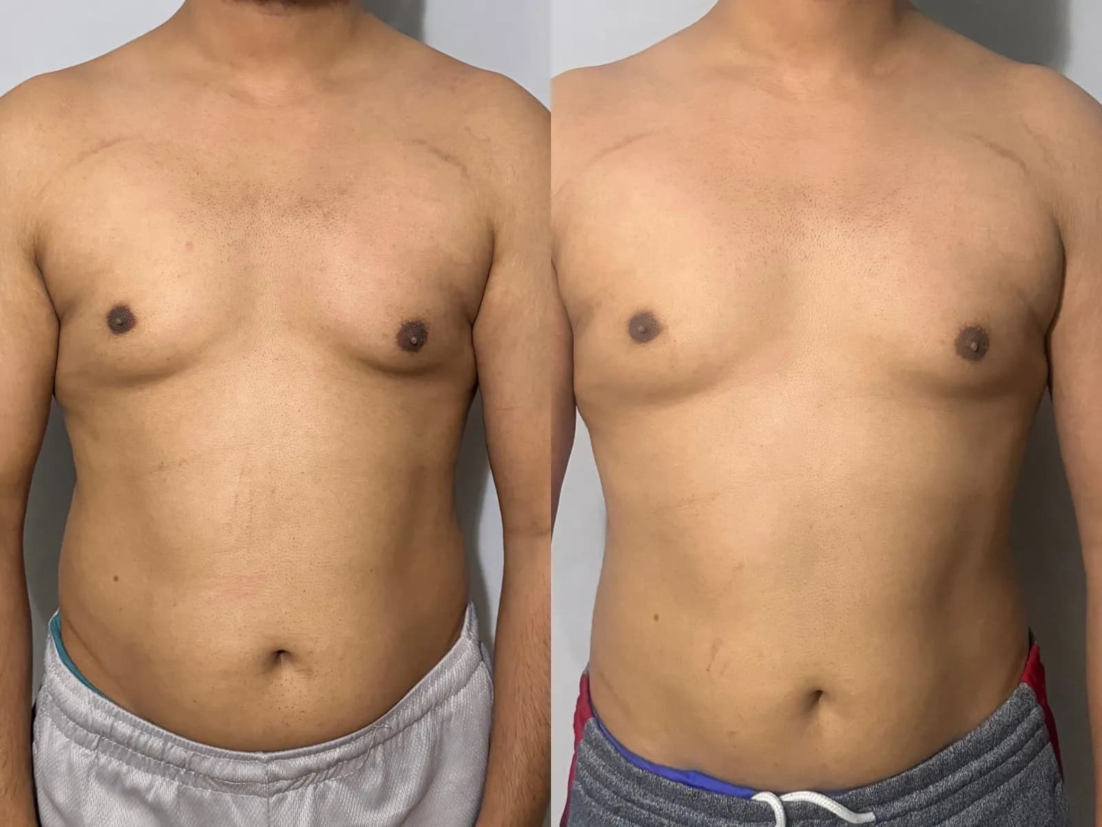 Muhamed transformation — before and after